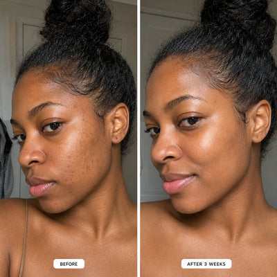 Glutathione Patches