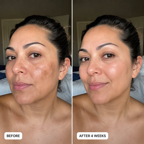 Glutathione Patches